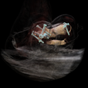 Data_Tibial-Fracture-after